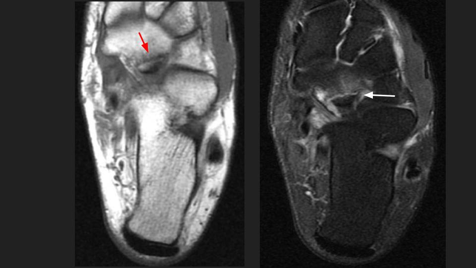 Figure 1 for case spring ligament ( RID3052 )